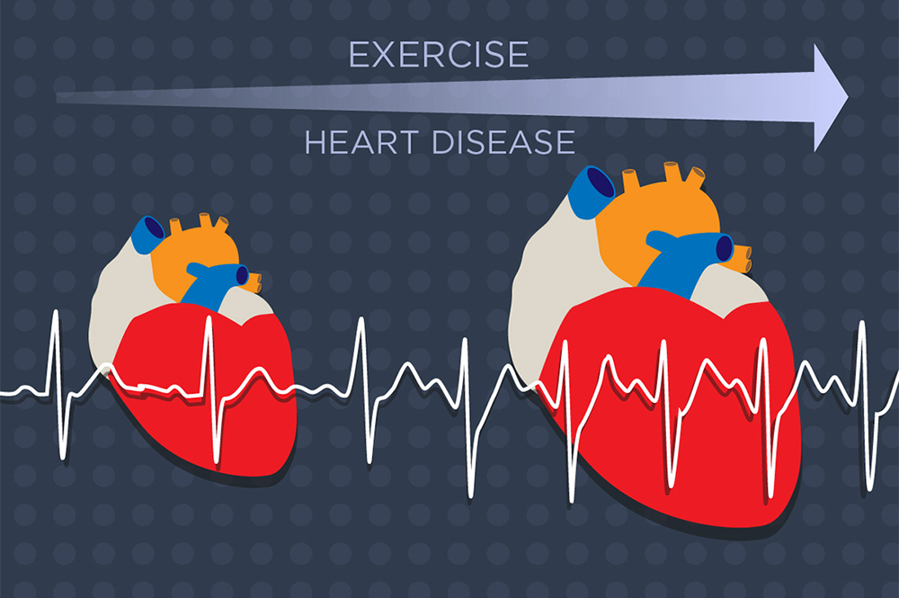 The heart enlarges in response to growing demands from exercise or heart disease. A new study identifies a key molecular player in this process. (Graphic by Julie McMahon.)