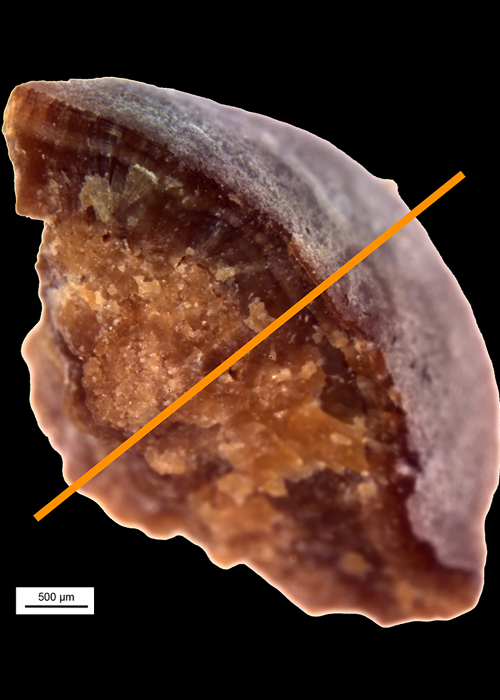 A human kidney stone from the Mayo Clinic. (Image provided by Mayandi Sivaguru, Jessica Saw from Bruce Fouke Lab, Carl R. Woese Institute for Genomic Biology, U of I.)
